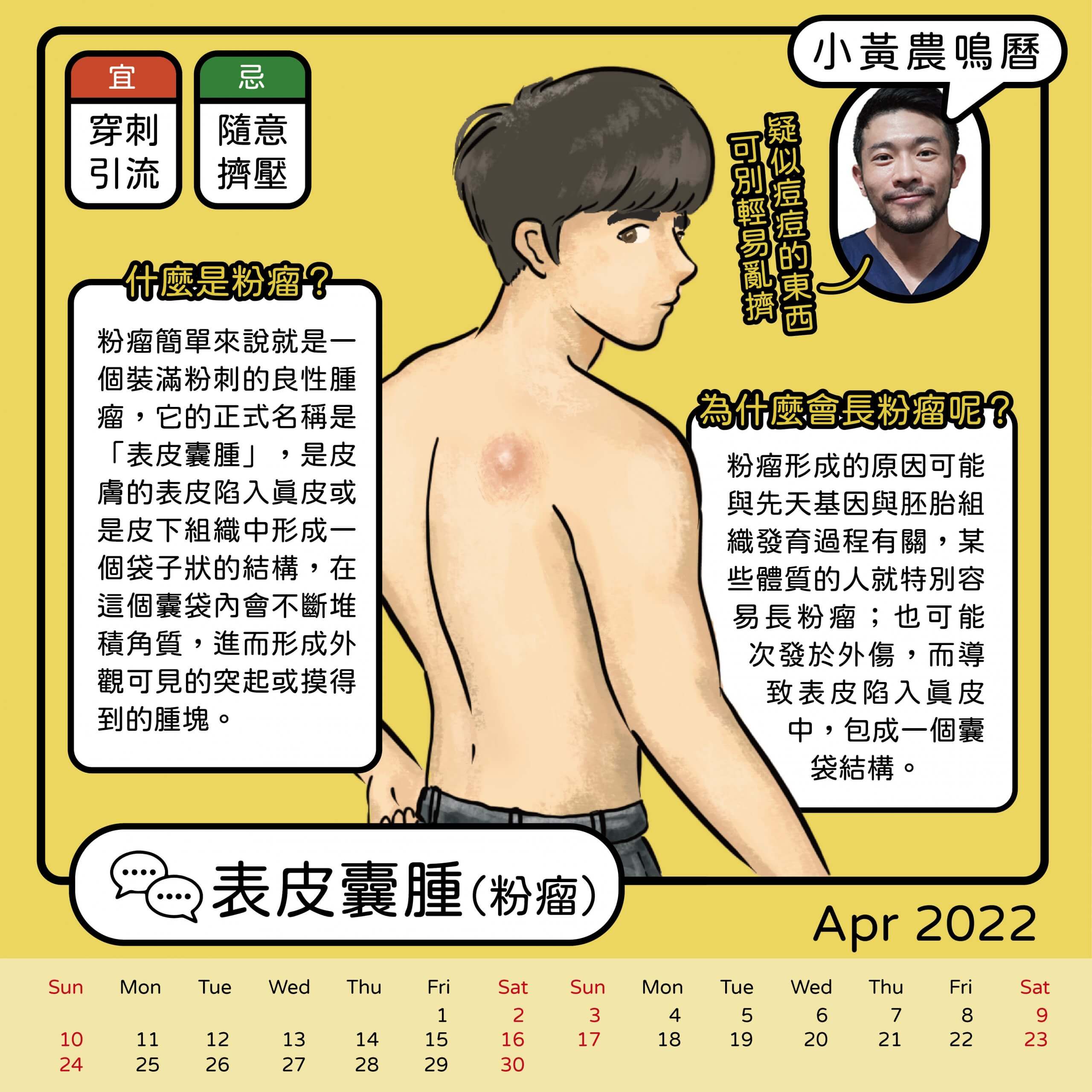 表皮囊腫 粉瘤 越 Lexcellence 更多專業文章