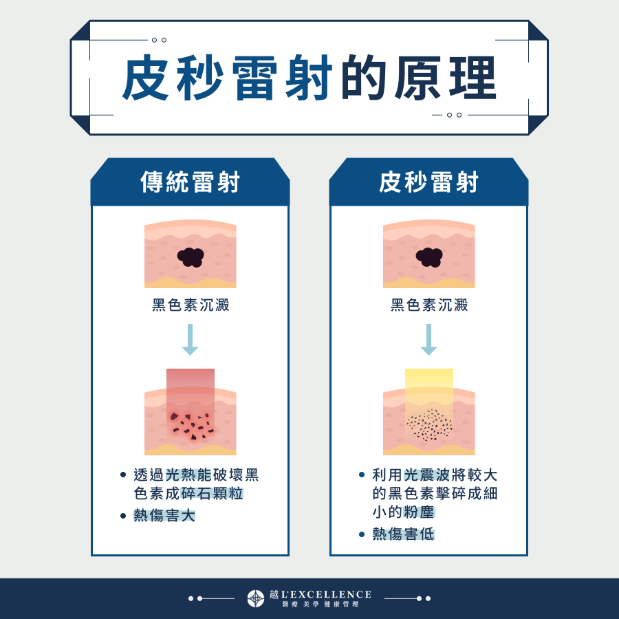 2025皮秒雷射QA一次看!專業醫生解惑皮秒術後注意事項 - Lexcellence'越