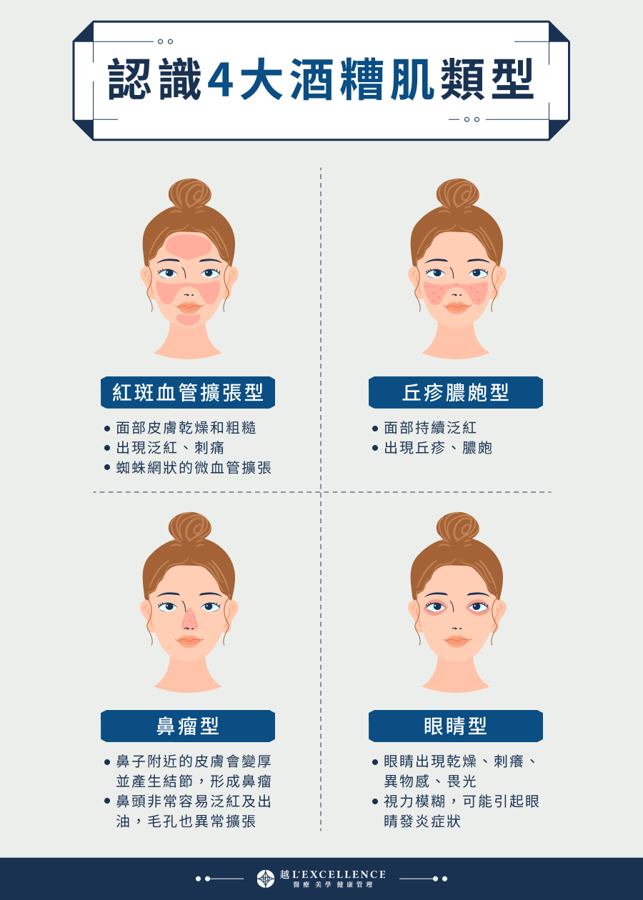 針對酒糟肌的護膚建議：十年皮膚科醫生教你高效舒緩紅腫泛紅攻略