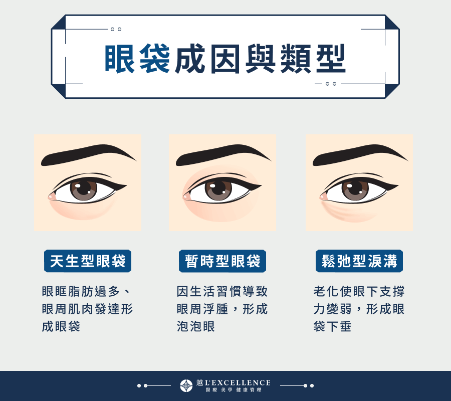 眼袋成因與類型