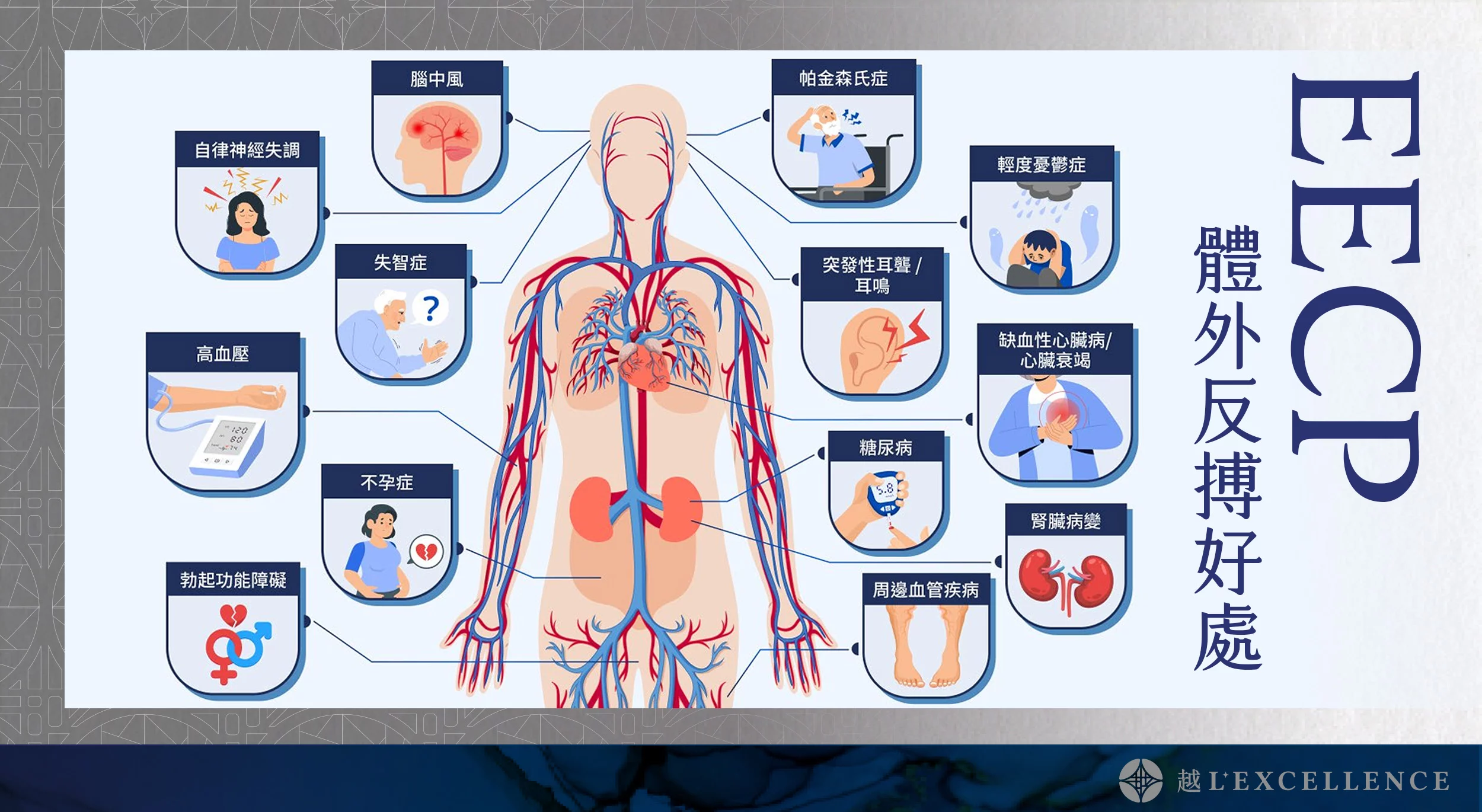 EECP、體外反搏、心臟復健、心絞痛改善、非侵入性心血管治療、血液循環療程、冠狀動脈輔助治療、促進血管新生 越診所04