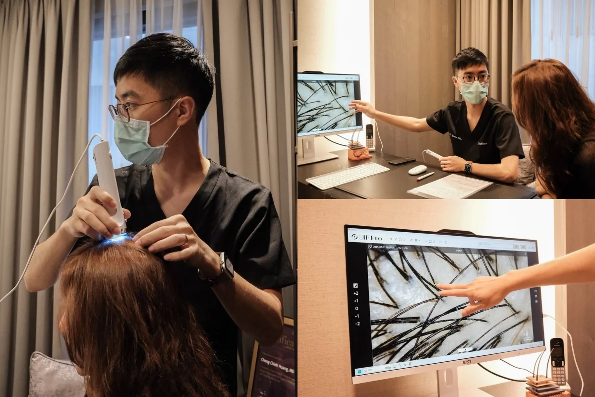 越診所頭皮諮詢