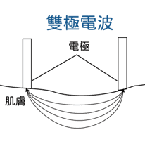 雙極微針電波能量傳遞示意圖｜越診所越境診所