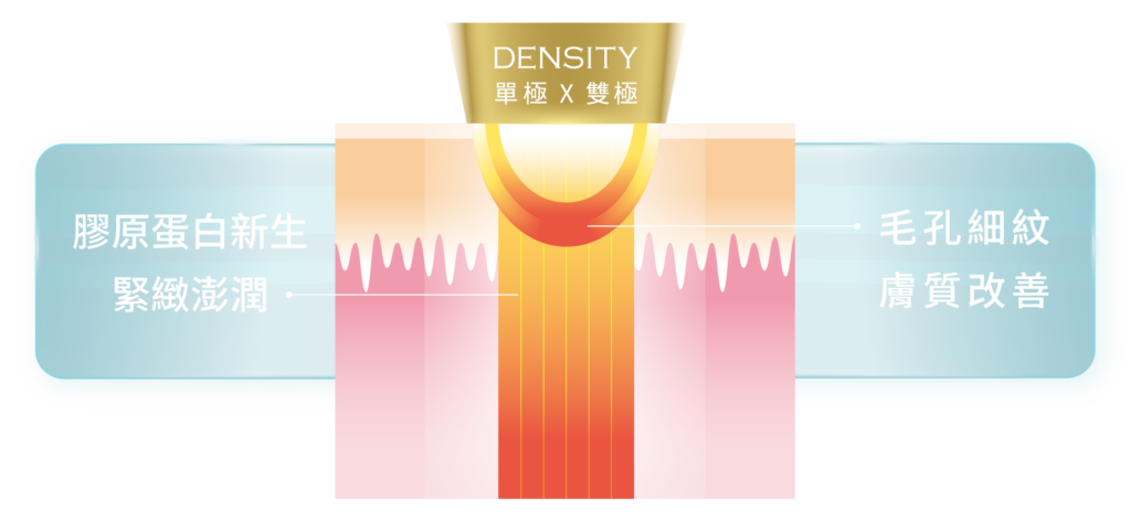 DENSITY 無雙電波 αLPHA 單極雙極專利技術示意圖