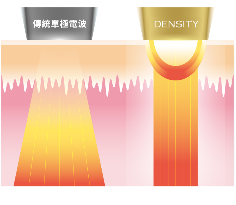 DENSITY 無雙電波絕對容積式加熱與傳統單極電波比較示意圖