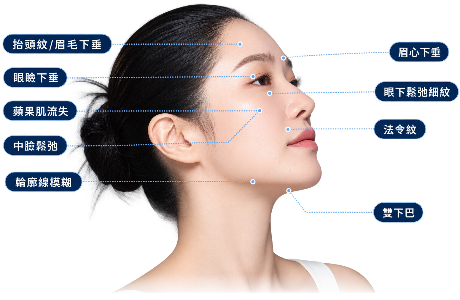EMFACE 菲斯波臉部治療建議