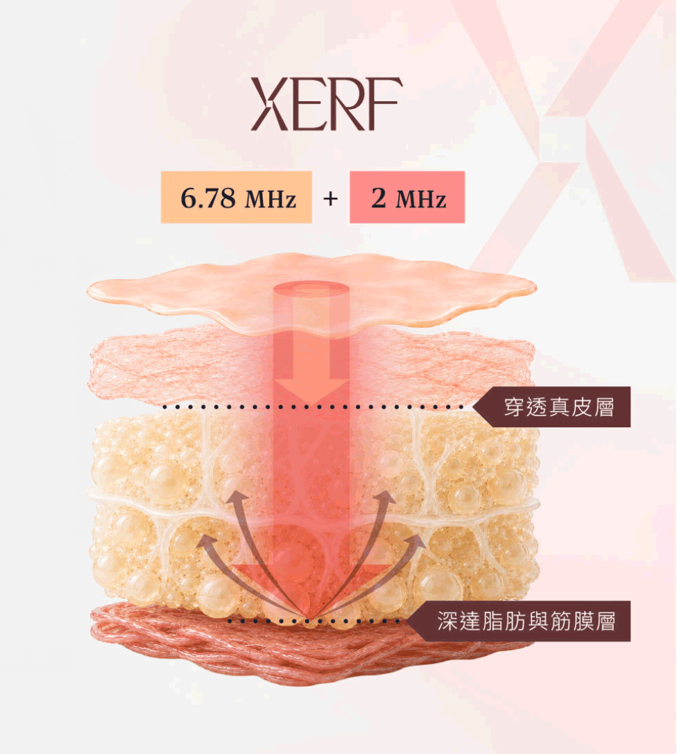XERF雙頻電波6.78MHz與2MHz作用原理