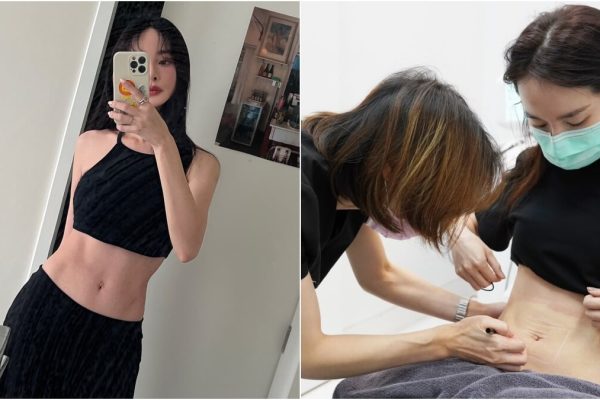 張圈_海芙音波_越診所