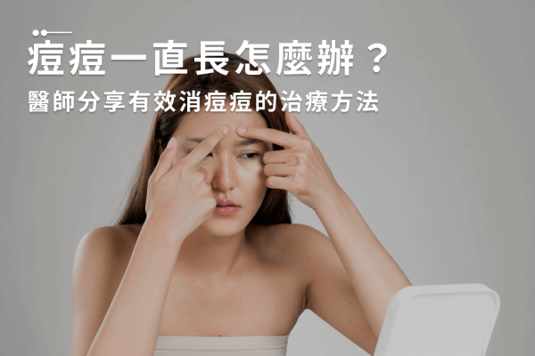 痘痘一直長怎麼辦？醫師分享有效消痘痘的治療方法！